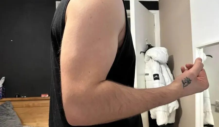 A client's bare upper arm, photographed at home.